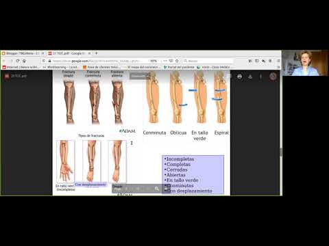 Vídeo: Clasificación WSES Y Pautas Para El Traumatismo Hepático