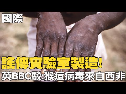 【每日必看】謠傳實驗室製造! 英BBC駁:猴痘病毒來自西非｜開出41.2萬份! 輝瑞口服Paxlovid成美治療主力 @中天新聞CtiNews   20220601