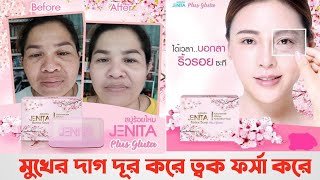 jenita botox soap | best whitening soap | মুখের ত্বক ফর্সা করে | khadija begum | shahnaz shimmul