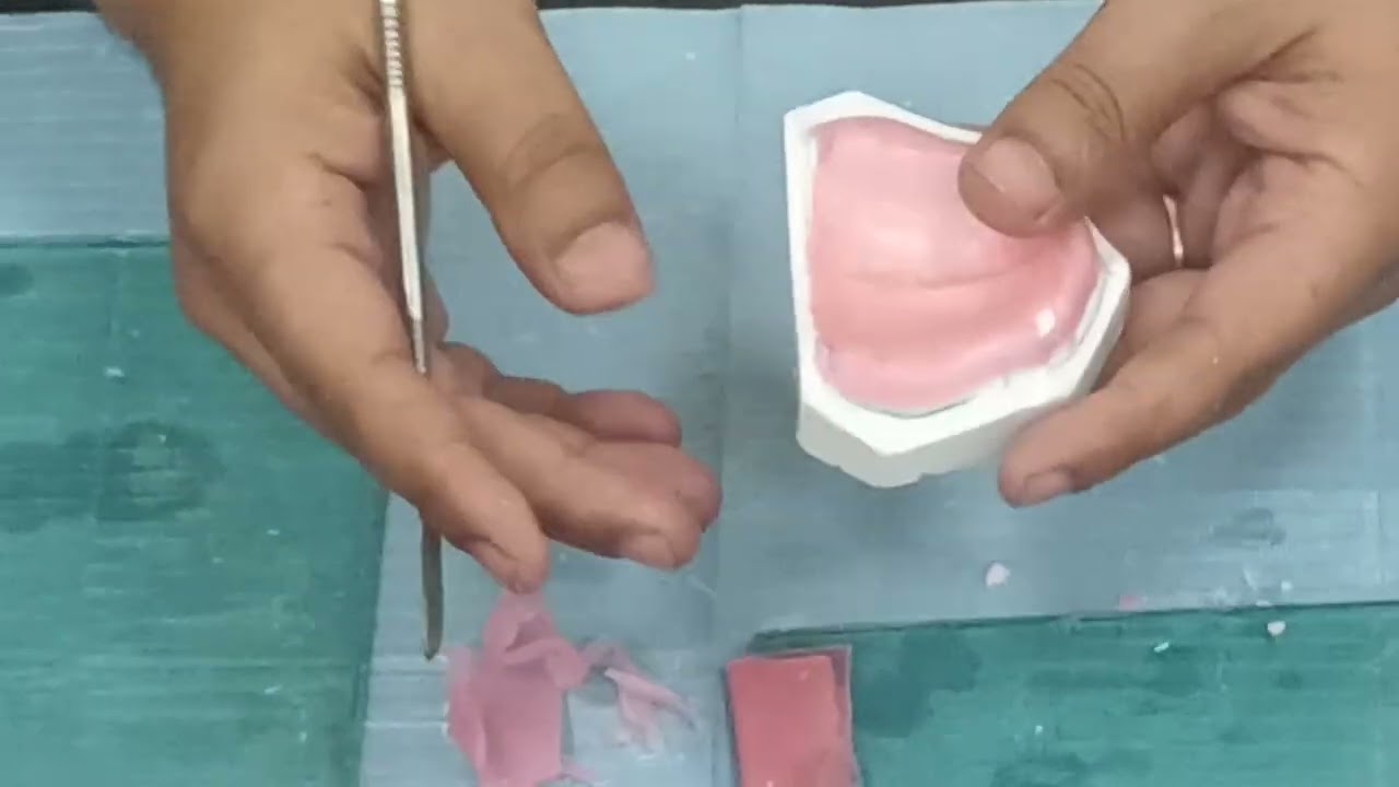 How to make a spacer for upper denture and make a special Tray 