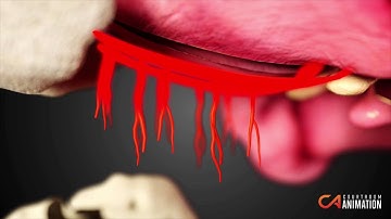 Summary of Injuries: Litigation Animation