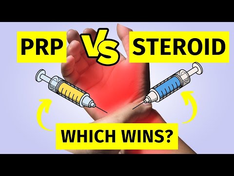 Синдром запястного канала: PRP или инъекция стероидов