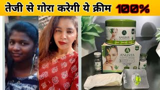 This Cream Will Make You Fair Faster Anusha Full 5 In 1 Kit Result 5 Days