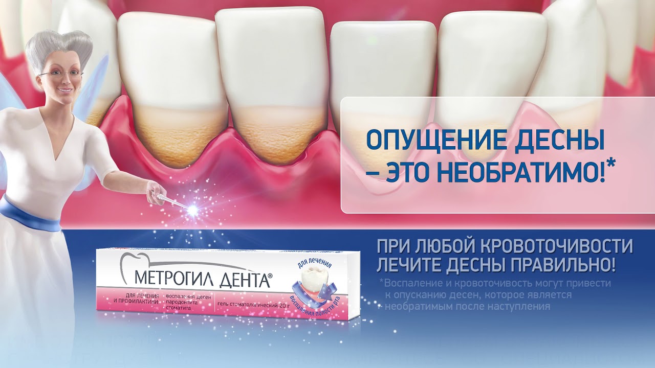 Метрогил Дента Аналоги Лучше – Telegraph