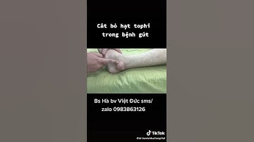 MỔ CẮT BỎ HẠT GÚT TOPHI GÂY KHÓ ĐI GIÀY ( ĐIỀU TRỊ BỆNH GÚT )