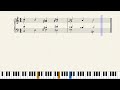 Miniature de la vidéo de la chanson Piano Concerto No. 4 In B-Flat Major, Op. 53 For The Left Hand: I. Vivace