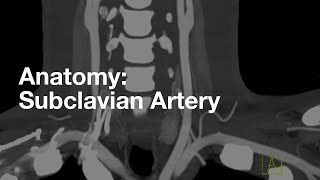 Subclavian Artery Anatomy