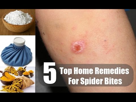 Video: Home Remedies Voor Spider Bites En Wanneer Medische Hulp Te Zoeken