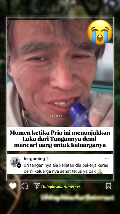 Luka di Tangan Pria ini bukan apa apa dibandingkan keluarga dan anaknya 🤯 #shorts