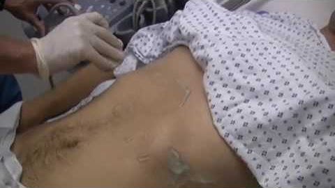 How To F A S T Focused Assessment by Sonography in Trauma