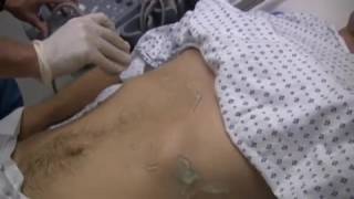 How To F A S T Focused Assessment by Sonography in Trauma