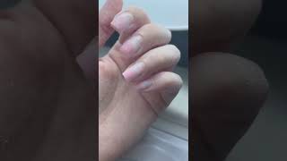 Суровая реальность ногтей мастеров маникюра💅 Знакомая история ? #nails #ногти