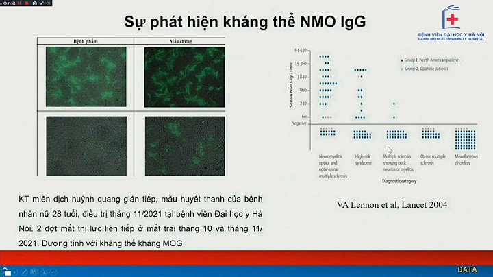 Bệnh viêm tủy thần kinh tên tiếng anh là gì năm 2024