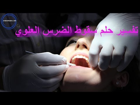    تفسير حلم سقوط الضرس العلوي