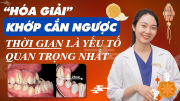 Trẻ Bị Khớp Cắn Ngược Nên Can Thiệp Tốt Nhất Ở Độ Tuổi Nào? | Nam Bui Vinalign