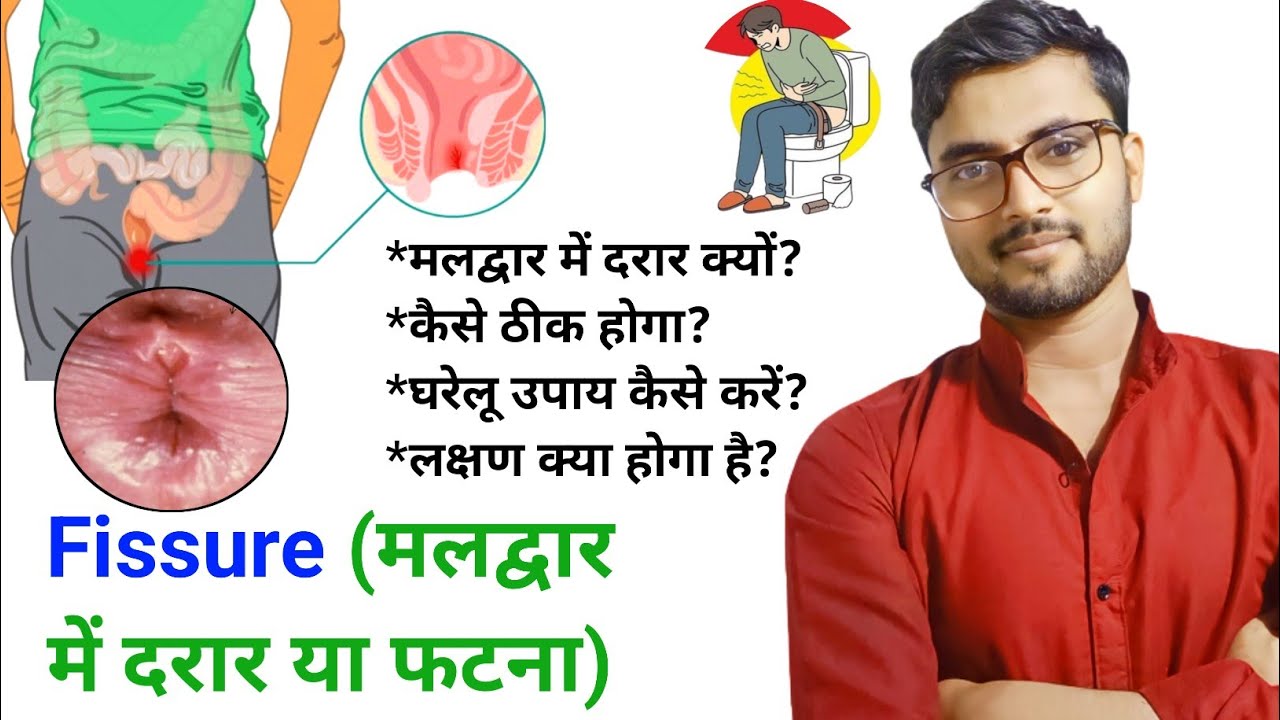 anus fissure treatment at home in hindi,fissure kaise hota hai, fissure