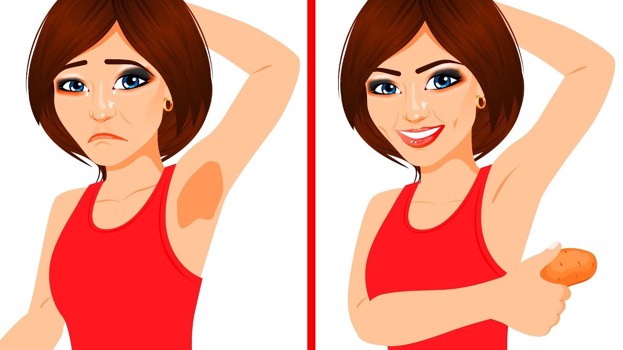 sivilce kremi Cildinizin Parlamasını Sağlayacak 11 Yiyecek