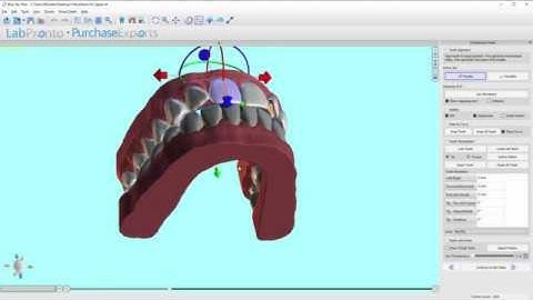 BlueSkyPlan v4.7.15: Step5 - Tooth Alignment