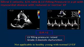 LV Systolic & Diastolic Function (Echo Assessment) by Dr. Debika Chatterjee Wealth