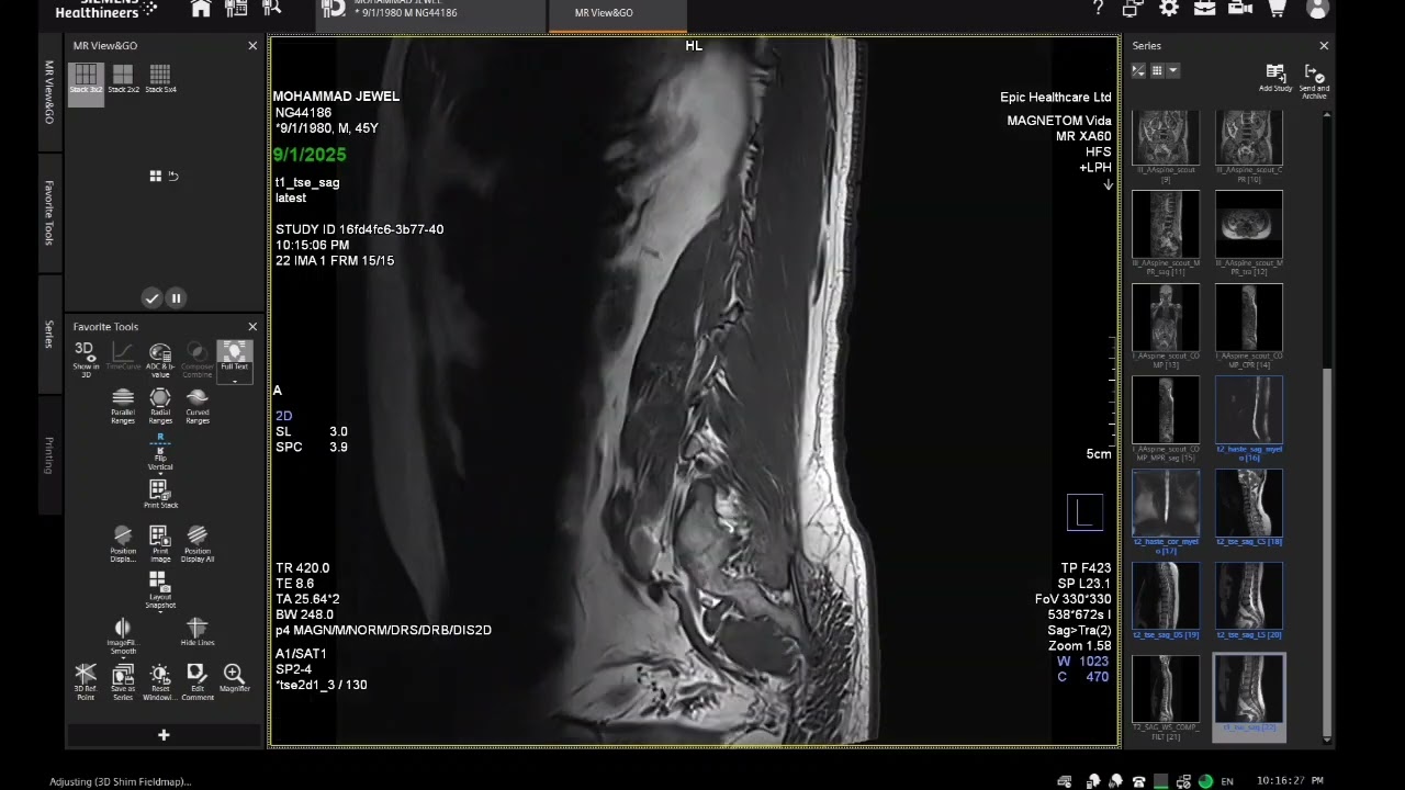 MRI of Lumber Spine Techniques & Filming Process || How to MRI lumber spine in magnetom vida 3T|| 