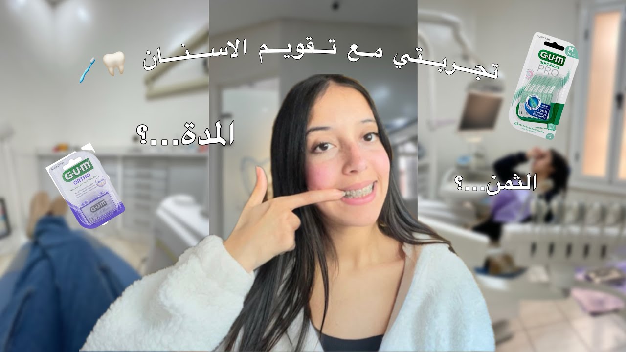 تجريبتي مع تقويم الأسنان 🦷🪥إيجابيات وسلبيات + الثمن