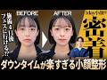 【1day小顔体験】頬まわりの脂肪・ほうれい線っぽい影は変わる？リアル経過を公開