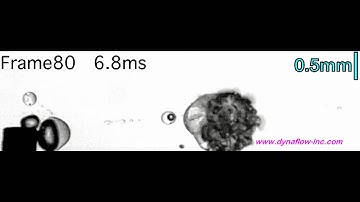 Thick Shell Contrast Agent Ultrasound   2