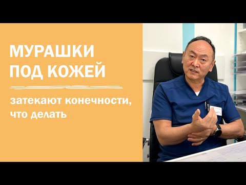 Что делать если мурашки под кожей | затекают руки и ноги | парестезия | врач невролог