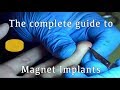 The Complete Guide to Magnet Implants