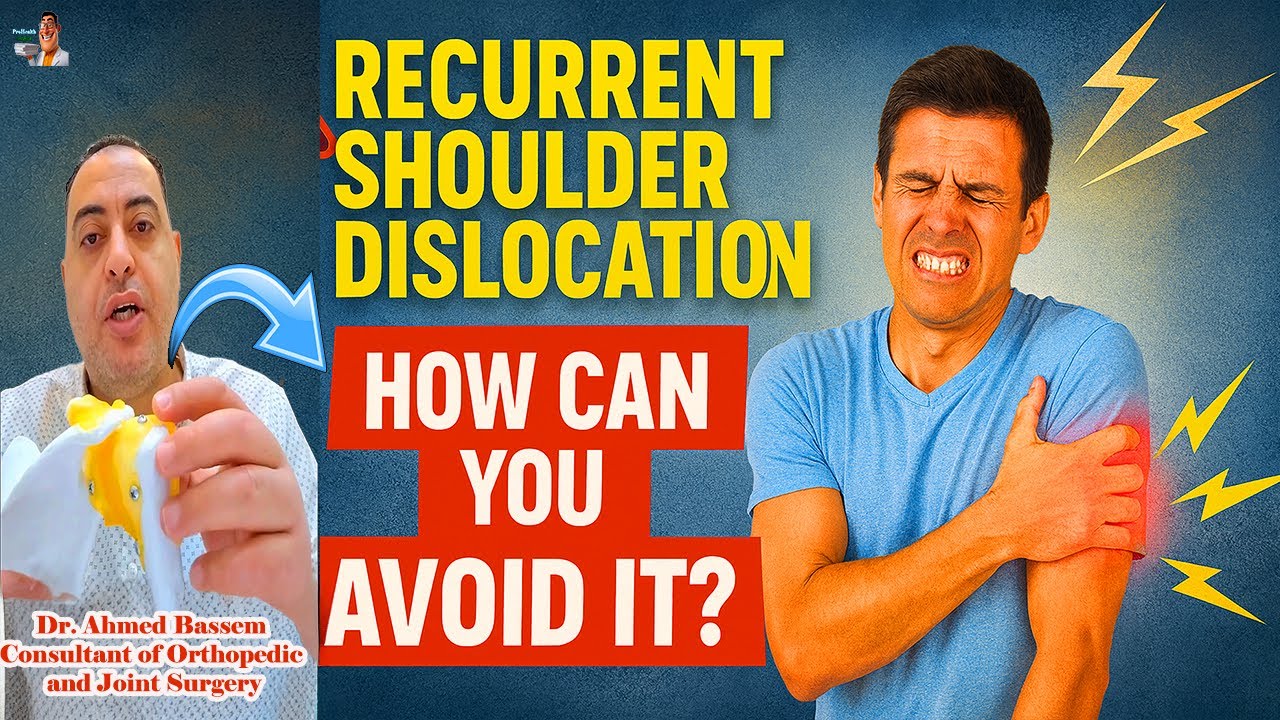 ⭐Dislocated Shoulder: Why It Keeps Happening & How to Prevent It