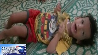 Derita Bocah Gizi Buruk [Sindo Siang] [17 Des 2015]