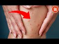 25 Insects That Call Human Bodies Their Home