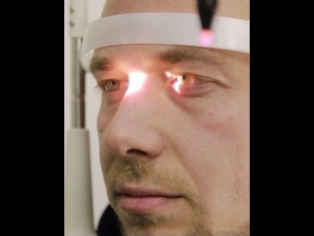 Glaucoma y ojo seco