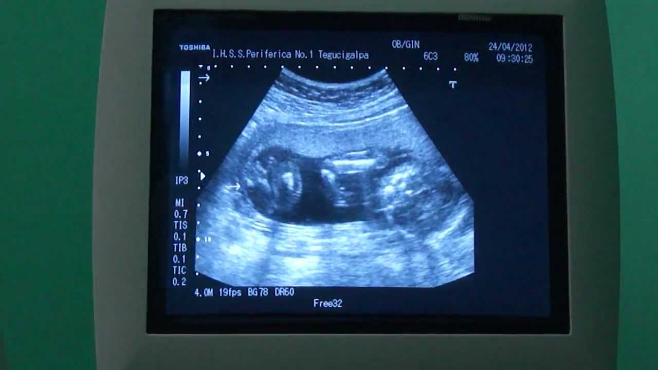 como esta un bebe de 16 semanas de embarazo