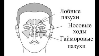 Бабочка-накладка для придаточных пазух носа