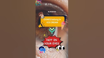 Keratoconus: A Progressive Corneal Ectasia #Keratoconus #Optometry #CornealEctasia  #OCUtalks