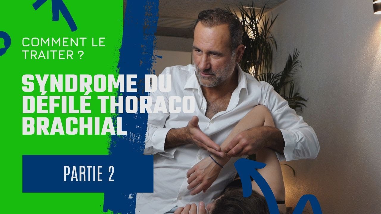 Comment traiter un syndrome du défilé thoracobrachial en ostéopathie — free download