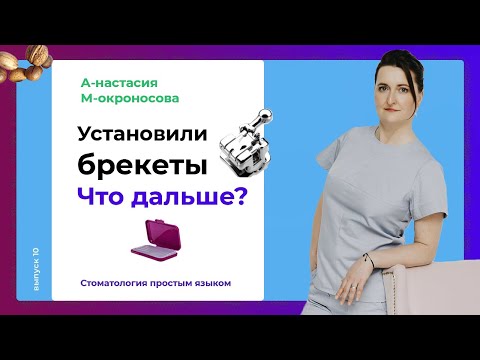 Что нельзя есть с брекетами? |  Ношение брекетов: уход и питание