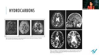 Inhalant Use Disorder - Ariell DeSure, M.D.