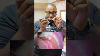 What Instruments help with Dental Restoration Procedures?