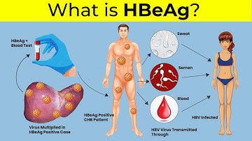Hepatitis B e Antigen | HBeAg | Hbeag Negative Treatment | Hepatitis | Hepatitis B