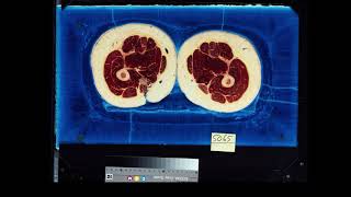 Visual Human Project Female Cadaver 4k60FPS