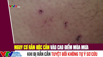 Nguy cơ rắn độc cắn vào cao điểm mùa mưa