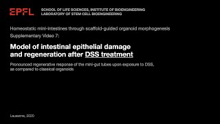 Supplementary Video 7: Model of intestinal epithelial damage and regeneration after DSS treatment