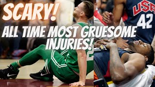 Nbas Most Gruesome Injuries Very Scary