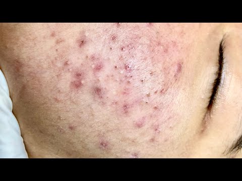 Satisfying video with Chung Vo Spa | 202