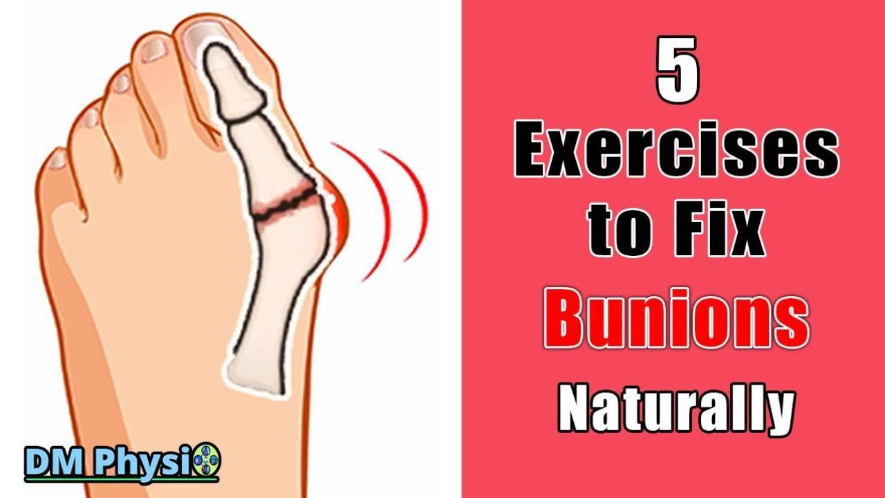 Realign Your Big Toe: 5 Proven Exercises