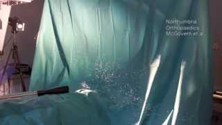Forced-air Patient Warming Causes Vortex That Deposits Contaminants Within Surgical Field
