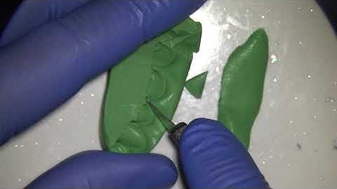 creating a buccal putty matrix for crown and veneer preparations