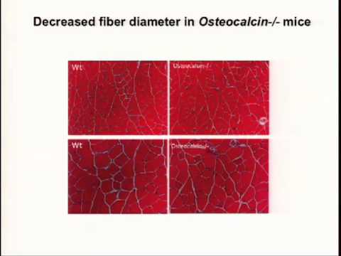 Karsenty: Osteocalcin and the Regulation of Muscle...